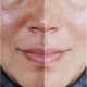 Facial pigmentation treatment cream, melasma and black spots